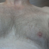 HERVEBI